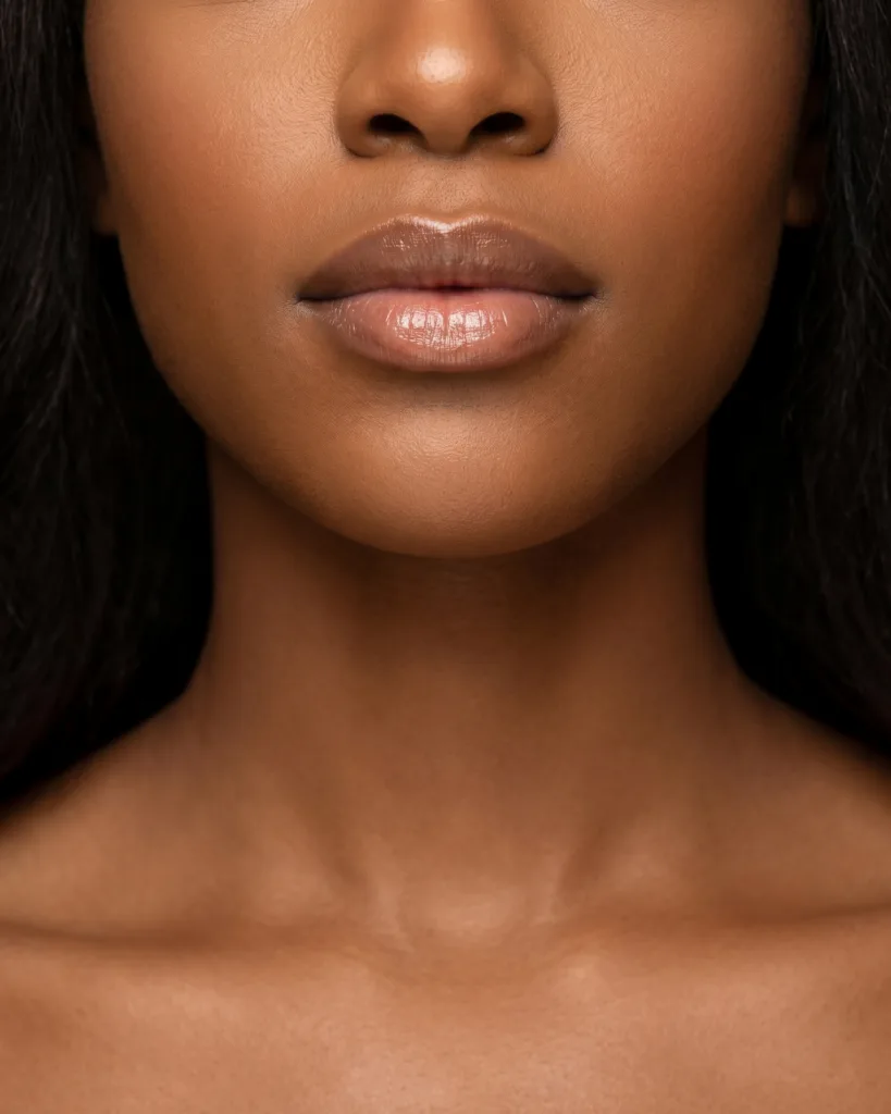 Lip surgery result at Colores Cosmetic Surgery in Hollywood, FL