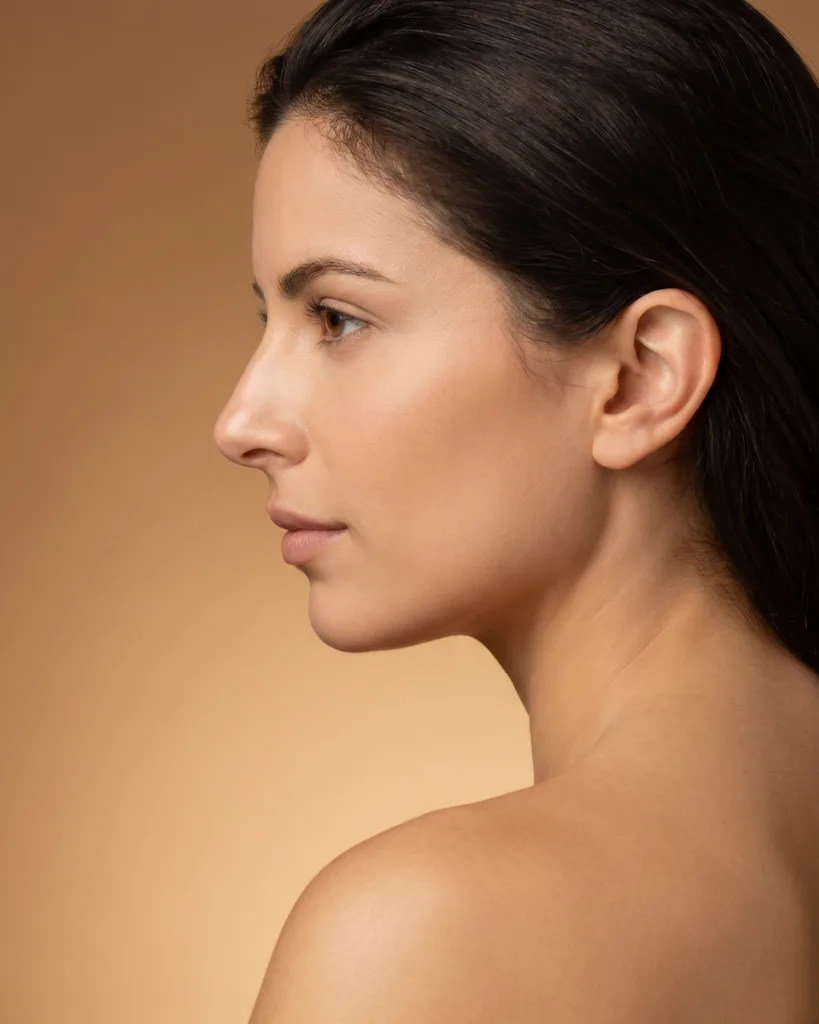 Rhinoplasty result at Colores Cosmetic Surgery in Hollywood, FL
